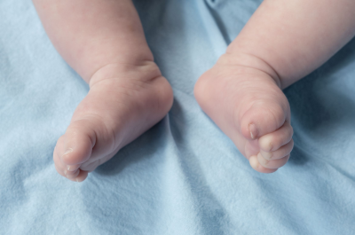 Hal yang Perlu Anda Ketahui Tentang Sianosis pada Bayi